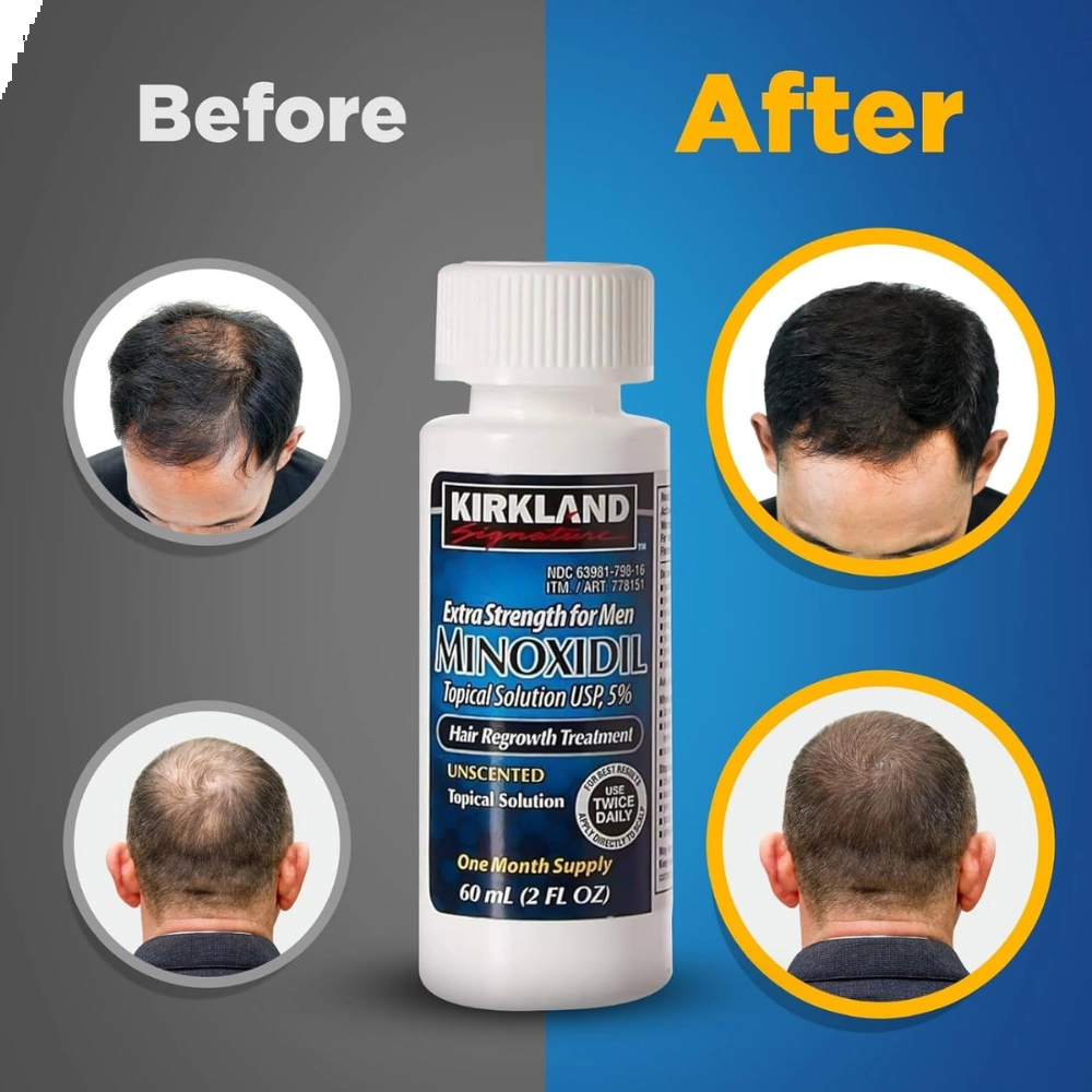 Minoxidil, Tratamento Capilar (Barba e Cabelo), 60ml, Kirkland