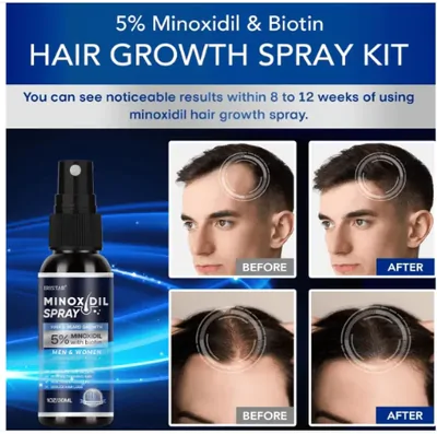 Minoxidil Spray 5%, Para Cabelos Mais Cheios e Grossos, 30ml Cada, Iristar
