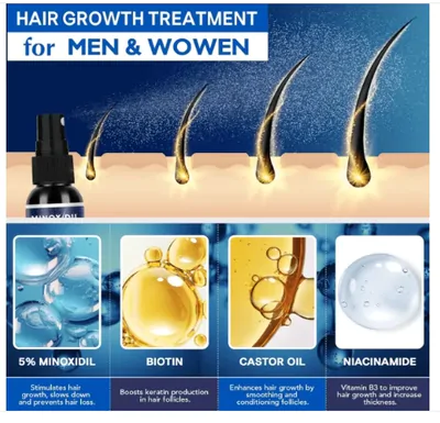 Minoxidil Spray 5%, Para Cabelos Mais Cheios e Grossos, 30ml Cada, Iristar