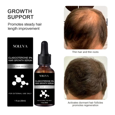 Clascoterone 5% Hair Restoration, Minoxidil, 30ml, NOLUVA
