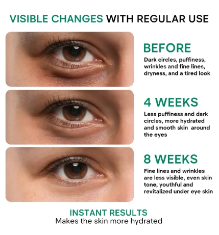 Eye Cream, Creme para os Olhos, 55ml, Remedial Pax