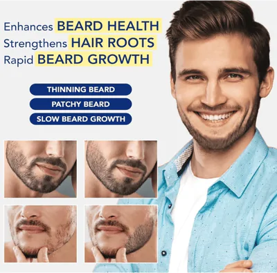 Minoxidil Spray 5%, Para Cabelos Mais Cheios e Grossos, 30ml Cada, Iristar