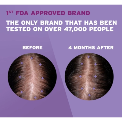 Rogaine para crescimento capilar feminino, Minoxidil 2%, 60ml