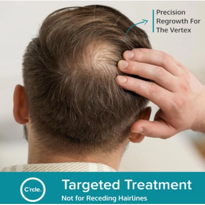  Espuma de Minoxidil 5% para Homens, Estimula o Crescimento Capilar, 60g, C'rcle