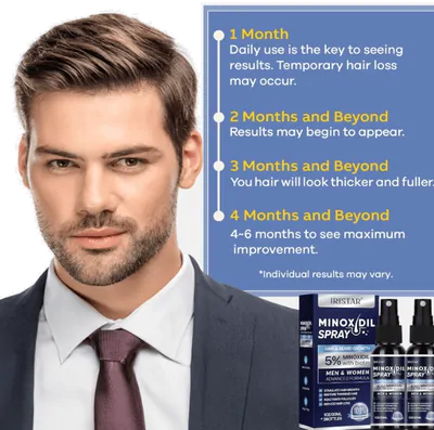 Minoxidil Spray 5%, Para Cabelos Mais Cheios e Grossos, 30ml Cada, Iristar