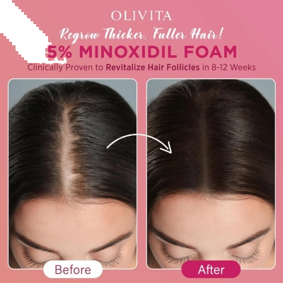 Minoxidil Foam 5%, Tratamento para Crescimento Capilar Feminino, 3x 60ml, Olivita