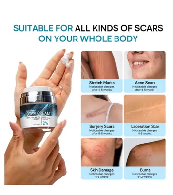 Scar Cream, Creme para Remoção de Cicatrizes, 55ml, Remedial Pax