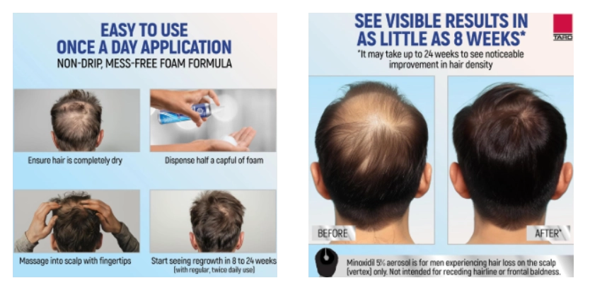 Minoxidil for Men 5%, Aerosol foam, Tratamento para Crescimento Capilar Masculino, 60g, TARO