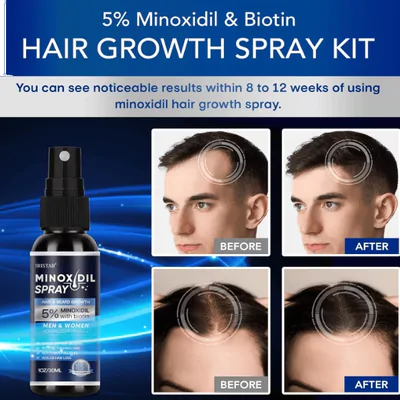 Minoxidil Spray 5%, Para Cabelos Mais Cheios e Grossos, 30ml Cada, Iristar