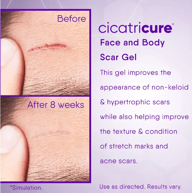 Gel para Cicatrizes, 28g, Cicatricure