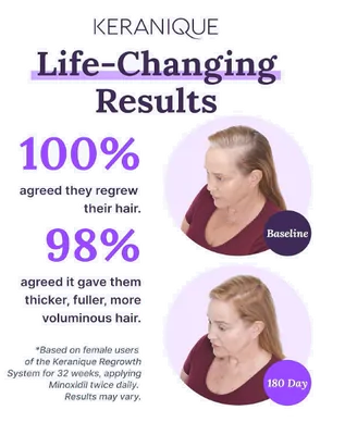 Tratamento para Crescimento Capilar Feminino, 2% Minoxidil,60ml com Spray de Precisão, Keranique