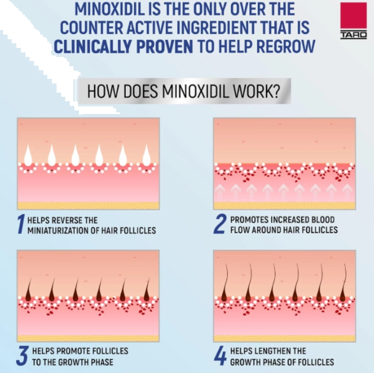 Minoxidil for Men 5%, Aerosol foam, Tratamento para Crescimento Capilar Masculino, 60g, TARO