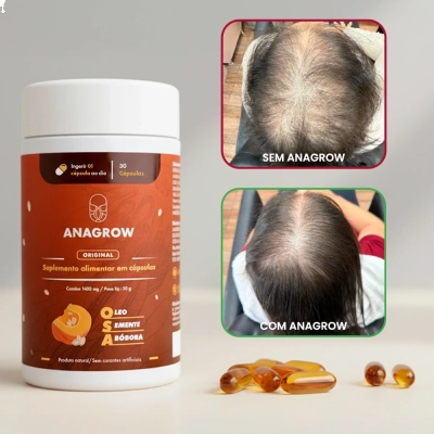 Vitamina Para Fortalecimento dos Cabelos OSA (Óleo de Semente de Abóbora), 30 Cápsulas, Anagrow