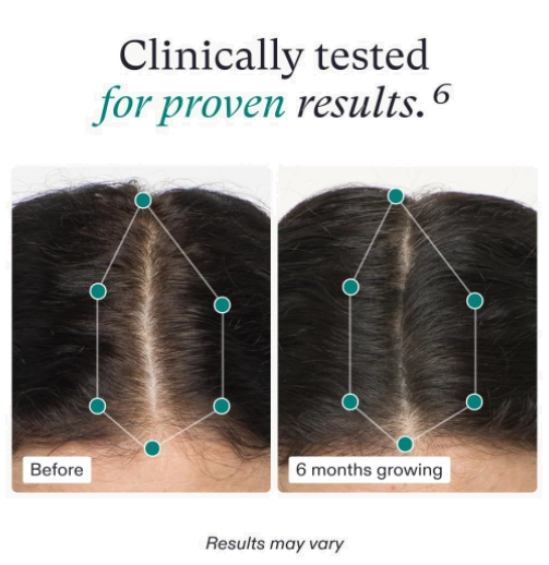 Suplemento Para Cabelos Femininos, Crescimento capilar e queda de cabelo, 120 cápsulas, Nutrafol