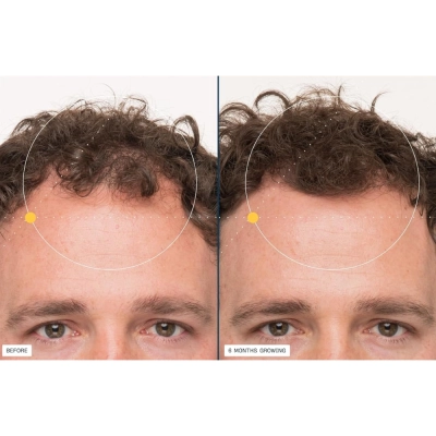 Nutrafol Men's Hair Growth, Para Crescimento Capilar Masculino, 120 cápsulas, Refil