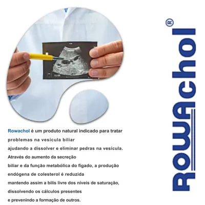 ROWACHOL, Auxilio para Eliminar Pedras na Vesícula, 50 Cápsulas, Rowa