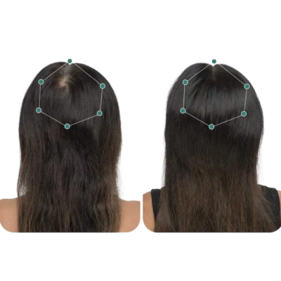 Suplemento Para Cabelos Femininos, Womens Vegan Clinically Proven Hair Growth, 120 Cápsulas, Nutrafol